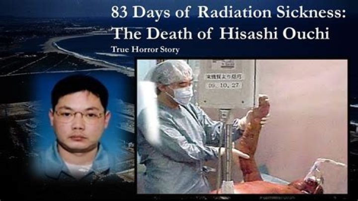 Hisashi Ouchi After Radiation Pictures: A Deep Dive into the Tragic Story