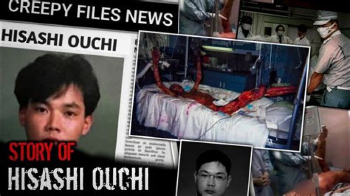 Hisashi Ouchi: The Untold Story Behind the Real Photo